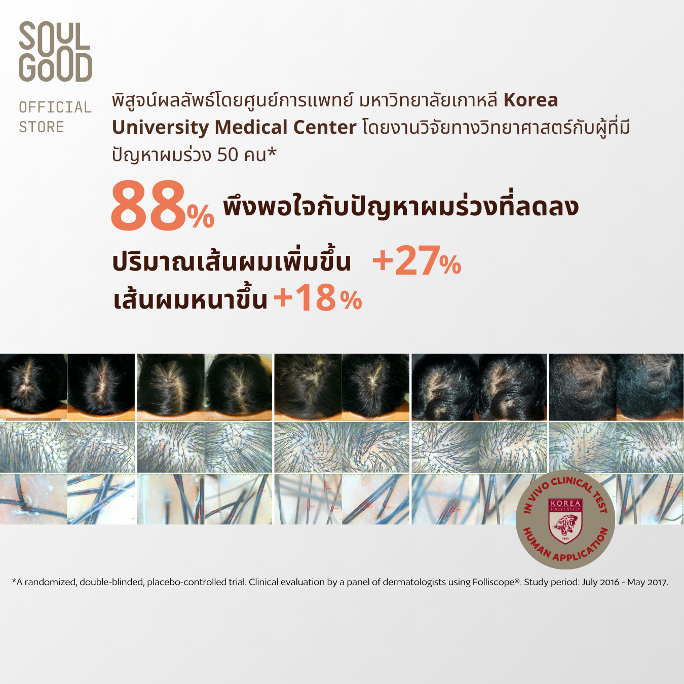 Probio Beer Anti Hair Loss Sensitive Scalp Shampoo 300ml